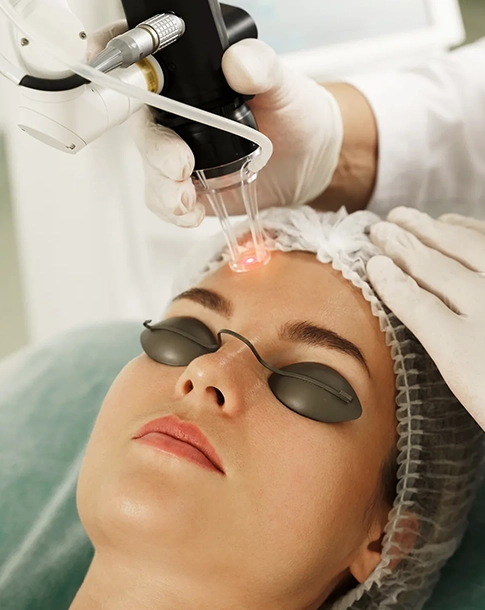 Woman Receiving Laser Treatment at a Medical Spa